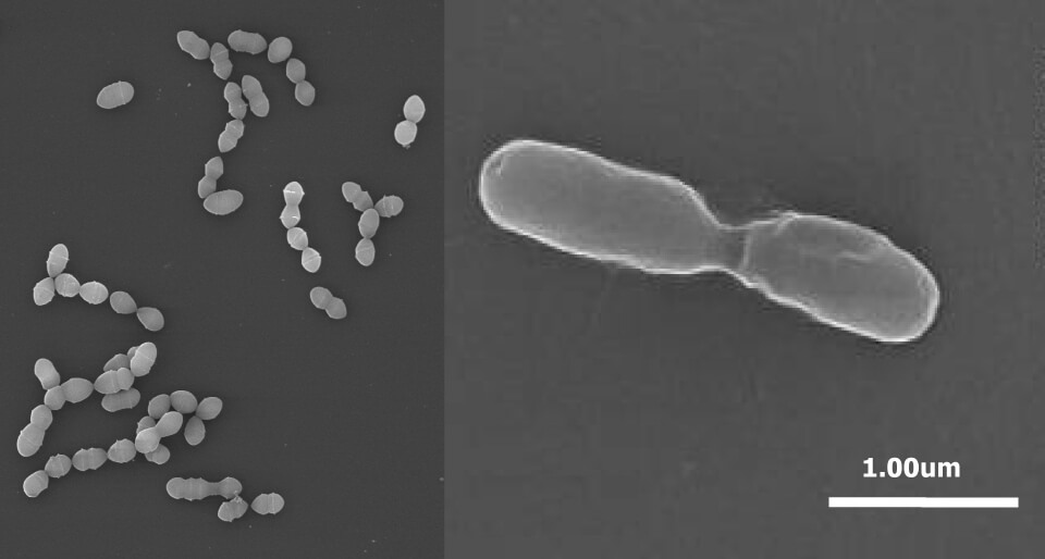 電子顕微鏡で見た乳酸菌の様子