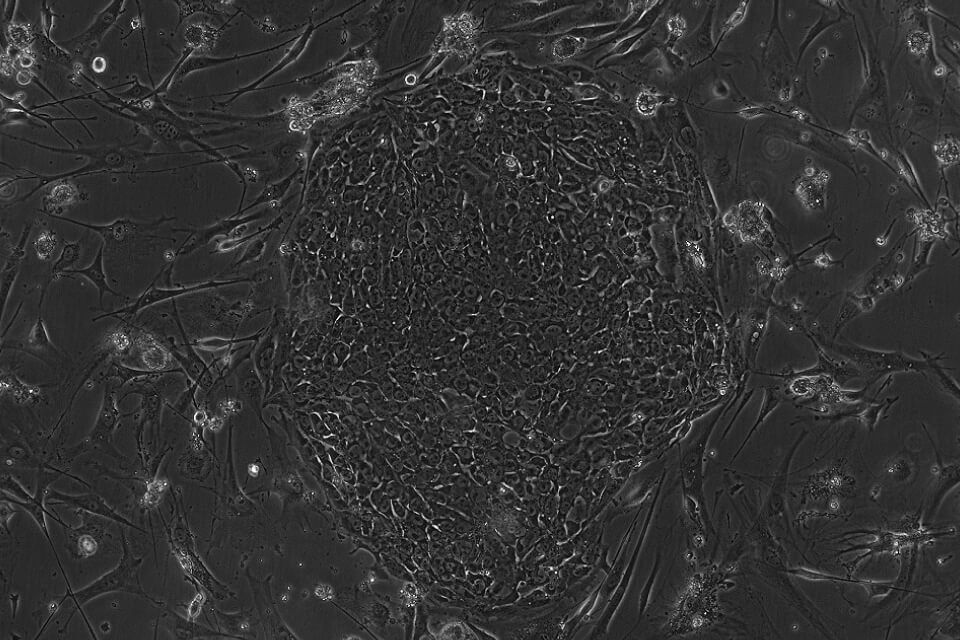 ヒト人工多能性幹細胞（iPS細胞）