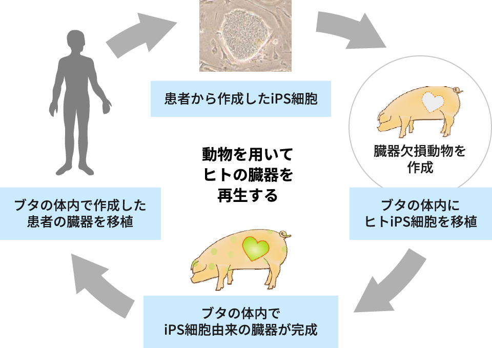 【動物を用いてヒトの臓器を再生する】患者から作成したiPS細胞→ブタの体内にヒトiPS細胞を移植→ブタの体内でiPS細胞由来の臓器が完成→ブタの体内で作成した患者の臓器を移植。この繰り返しイメージ