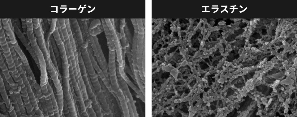エラスチンとコラーゲン