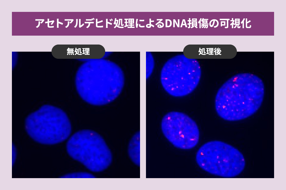 蛍光顕微鏡の細胞の写真