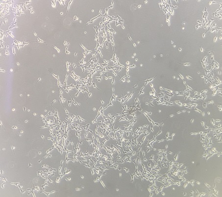cancercell